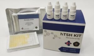 UB Kembangkan Alat Deteksi Dini Hipotiroid ELISA untuk Bayi Baru Lahir