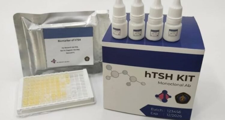 UB Kembangkan Alat Deteksi Dini Hipotiroid ELISA untuk Bayi Baru Lahir